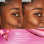 Glow Recipe Niacinamide Dewy Flush Tinted Liquid Blush Serum - Glowy Blush for Cheeks to Smooth, Hydrate & Brighten - Liquid Korean Makeup with Buildable, Warm Berry Plum Tint - Berry Flush (0.4 oz) - Image 5